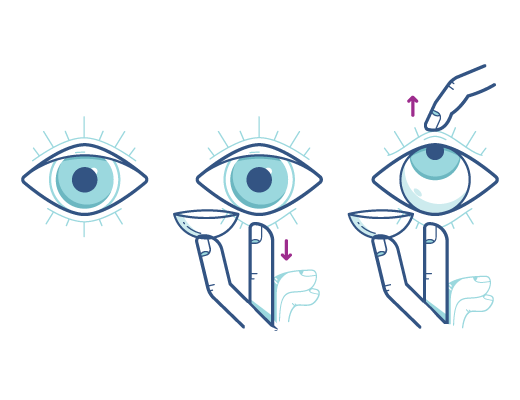 contact lenses contact lenses