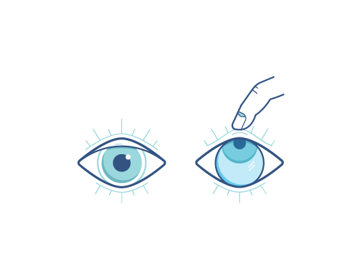 contact lenses contact lenses