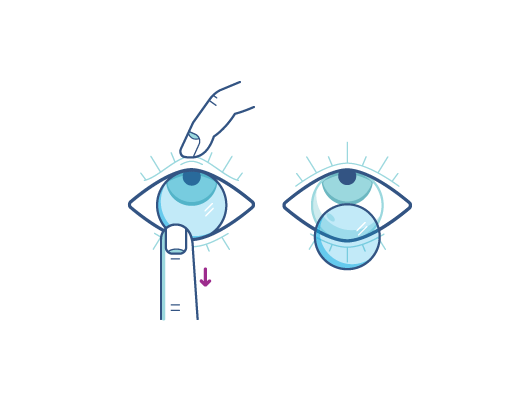 contact lenses contact lenses