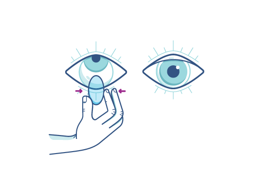 contact lenses contact lenses